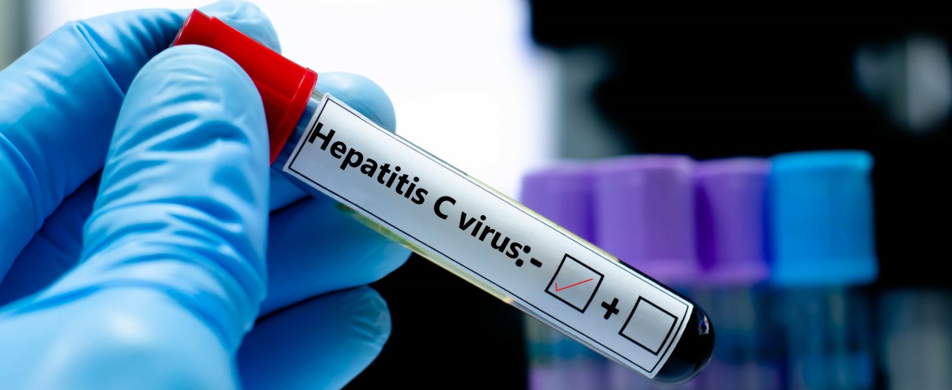 Xét nghiệm viêm gan B có được bảo hiểm y tế chi trả không?