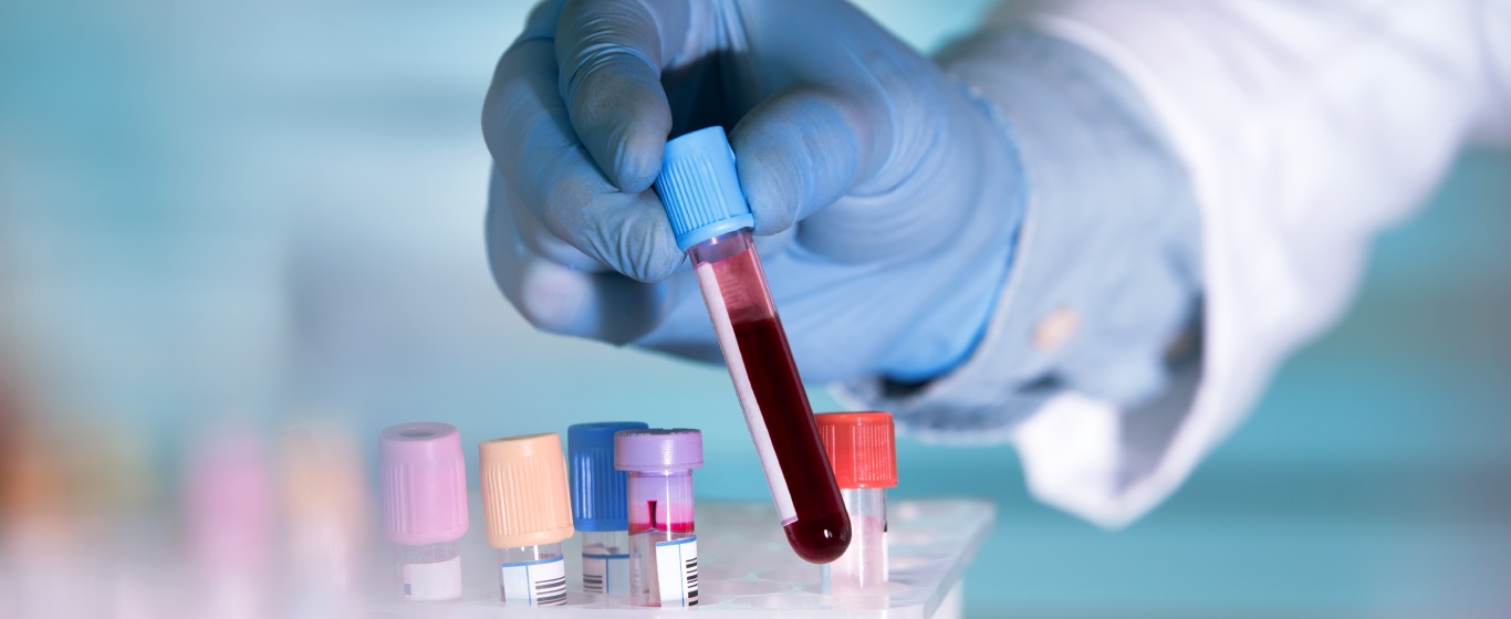 Khám tổng quát - Đánh giá sức khỏe toàn diện với 4 danh mục