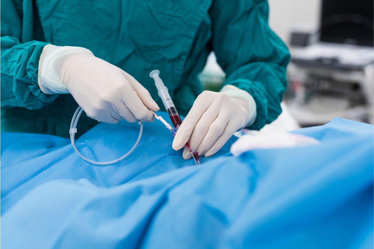 chi-phi-dat-stent-co-bao-hiem-y-te-la-bao-nhieu-tien-1200x800-1