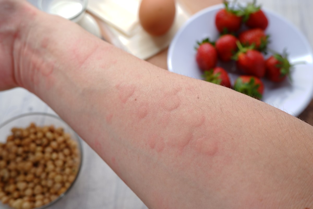 10-van-de-suc-khoe-tuyet-doi-khong-duoc-lo-la-sau-40-tuoi-phan-1-1200x800-04