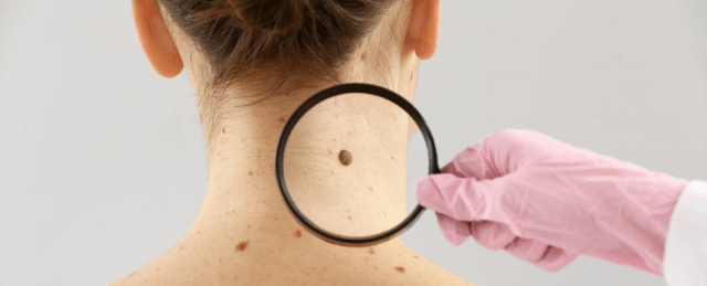 pulse-nhip-song-khoe-not-ruoi-bat-thuong