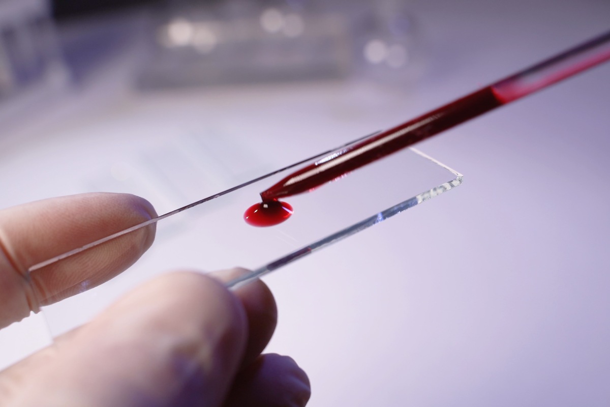 xet-nghiem-tuyen-giap-co-duoc-bao-hiem-khong-va-chi-phi-the-nao-1200x800-2